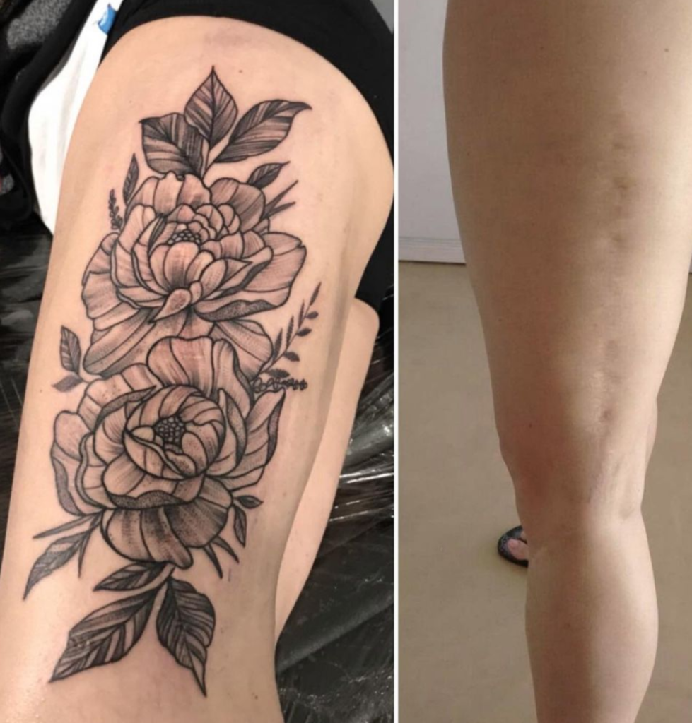 tatuagem para cobrir cicatriz 16