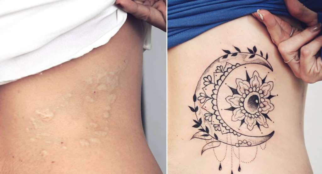 tatuagem para cobrir cicatriz 19