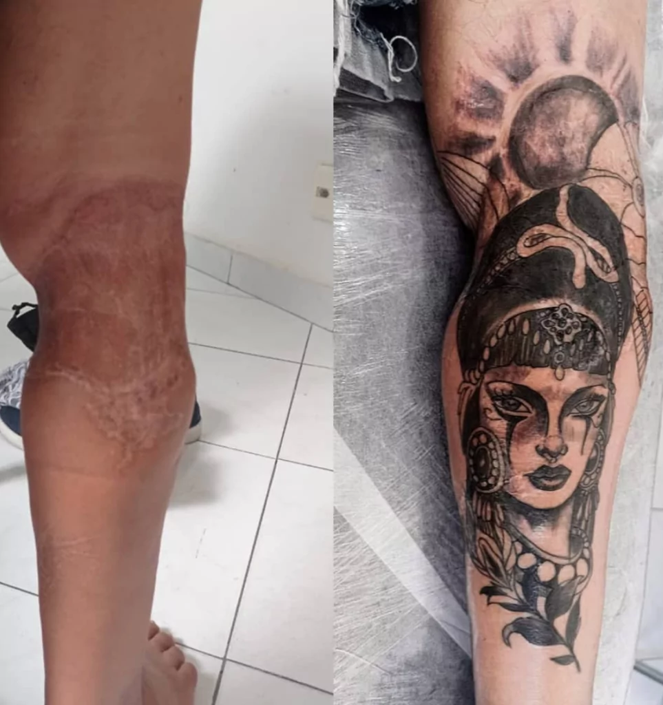 tatuagem para cobrir cicatriz 20