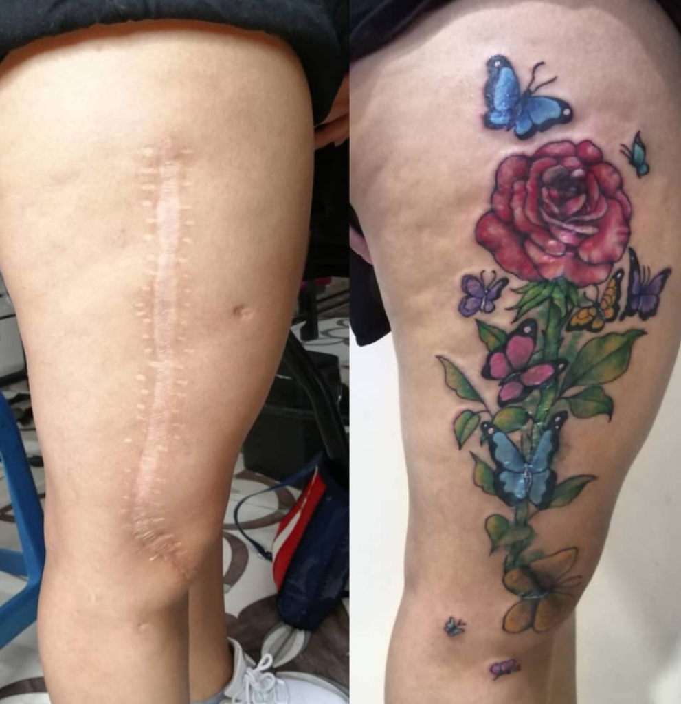 tatuagem para cobrir cicatriz 5