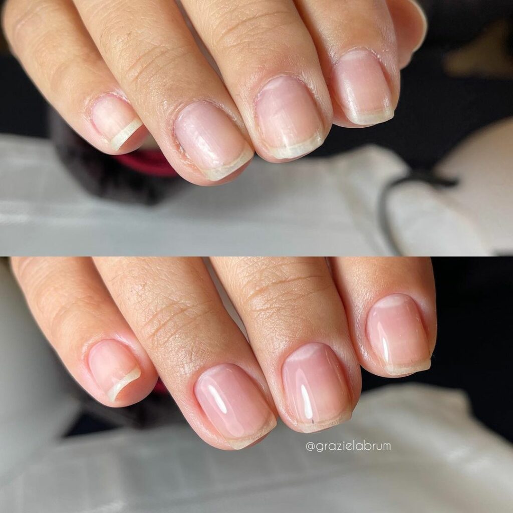 blindagem de unhas antes e depois